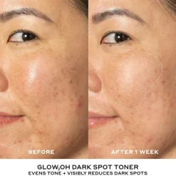 Skincare Starter Set