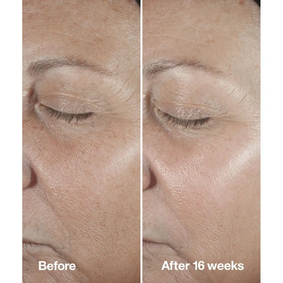 Smart Clinical Repair Wrinkle Correcting Serum