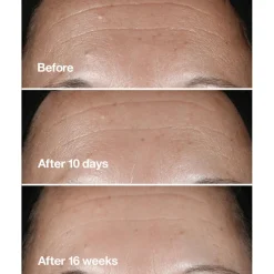 Smart Clinical Repair Wrinkle Correcting Serum