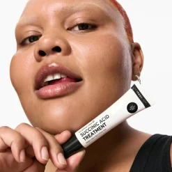 Succinic Acid Treatment