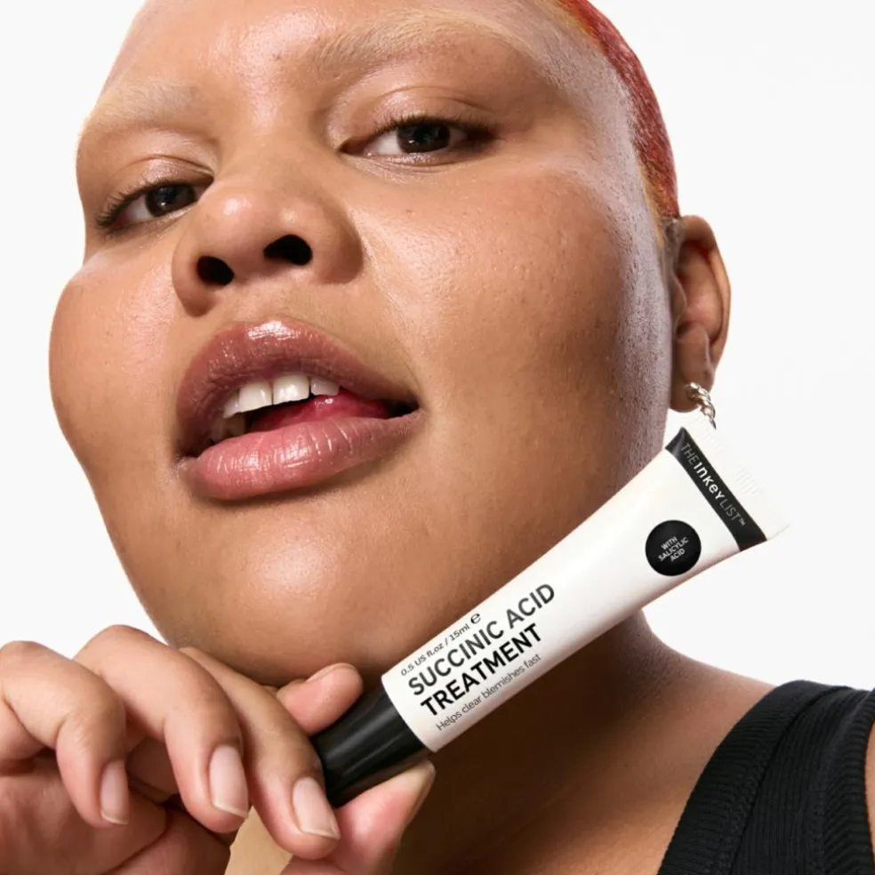 Succinic Acid Treatment