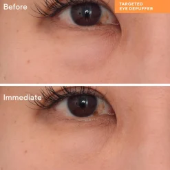 Targeted Eye Depuffer