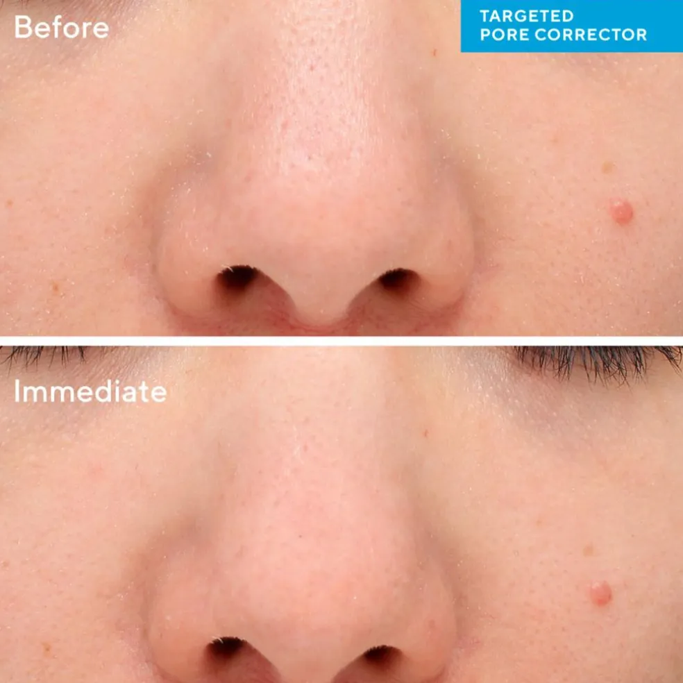 Targeted Pore Corrector