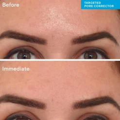 Targeted Pore Corrector