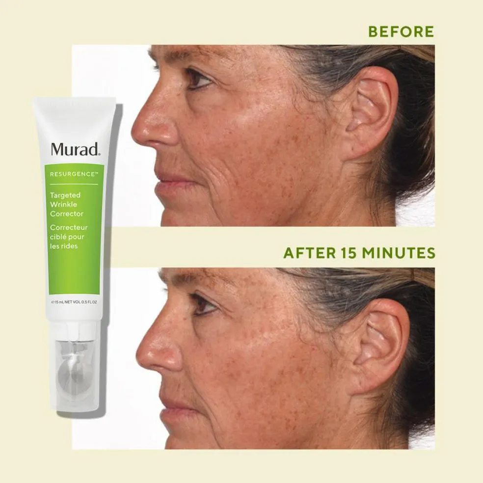 Targeted Wrinkle Corrector