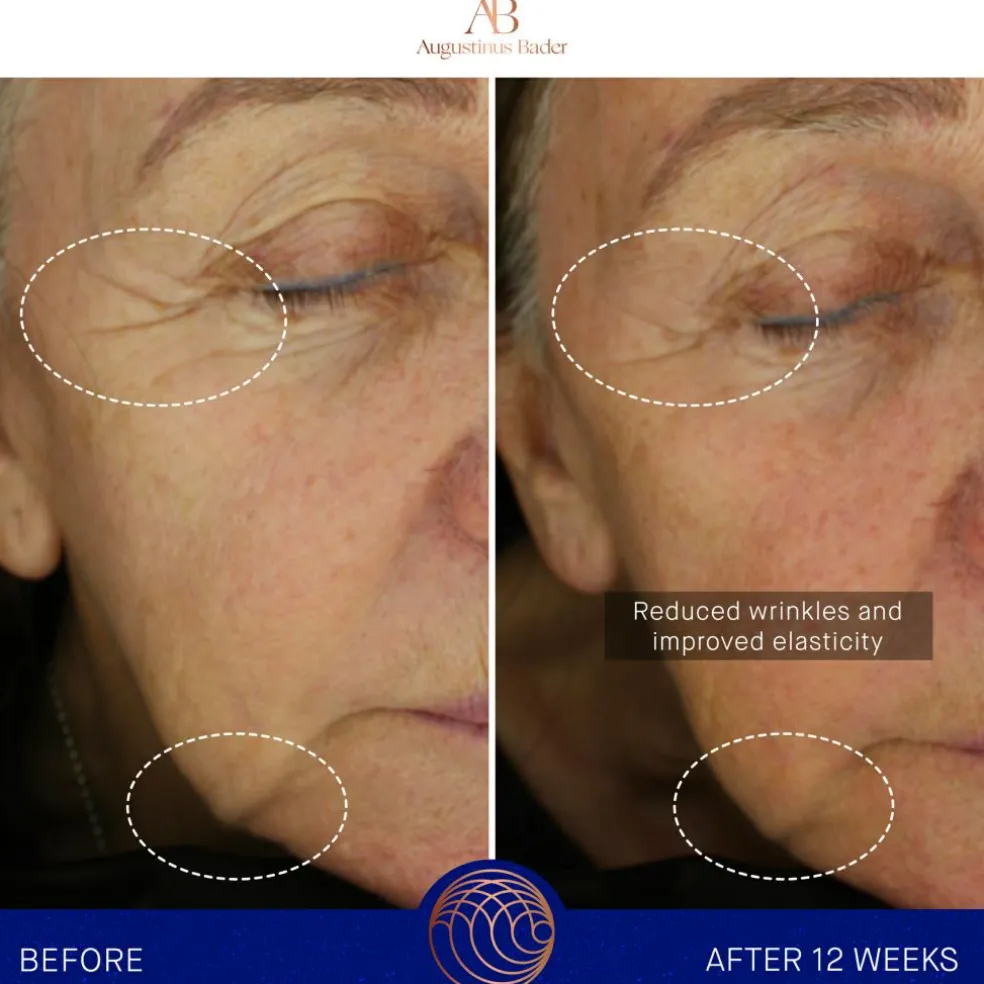 The Essence Soothing Cream