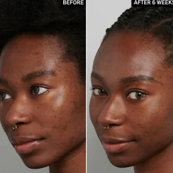 Tranexamic Acid Serum