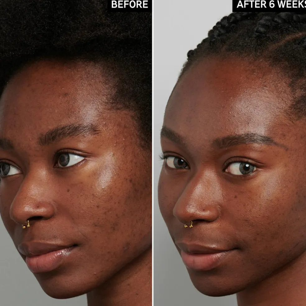 Tranexamic Acid Serum