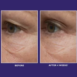 Ultimate Solution 5™ Multitasking