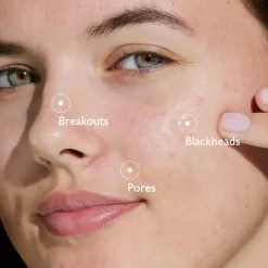 Vinopure Blemish Control Salicylic Serum