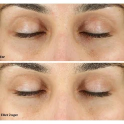 Vita-C Eyes Dark Circle Corrector