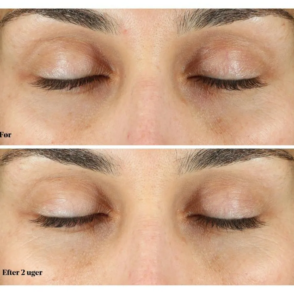 Vita-C Eyes Dark Circle Corrector