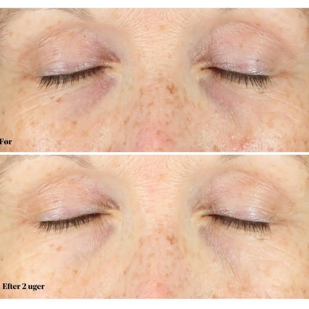 Vita-C Eyes Dark Circle Corrector