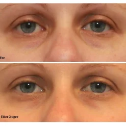 Vita-C Eyes Dark Circle Corrector