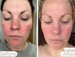 Wavelength LED Face Mask